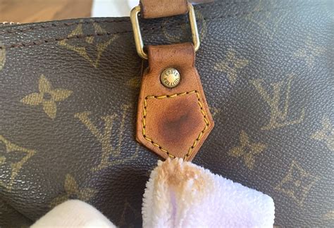 how to clean lv leather|louis vuitton leather treatment.